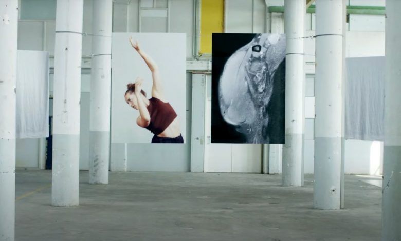 Campaña de Phillips | The Real Picture